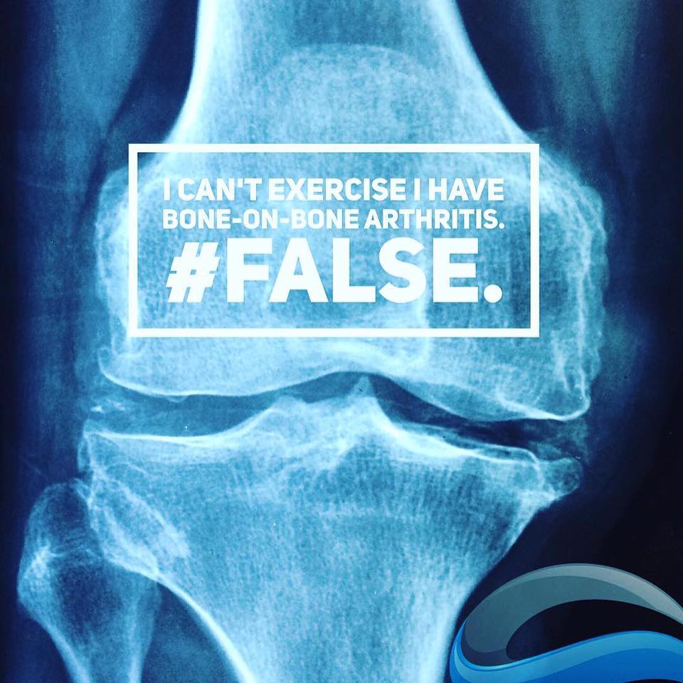 arthritis, knee pain, exercise, physiotherapy